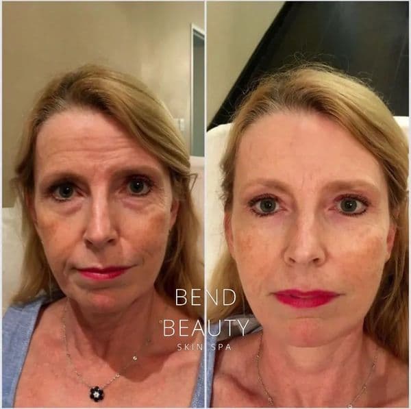 Client before-and-after comparison 1