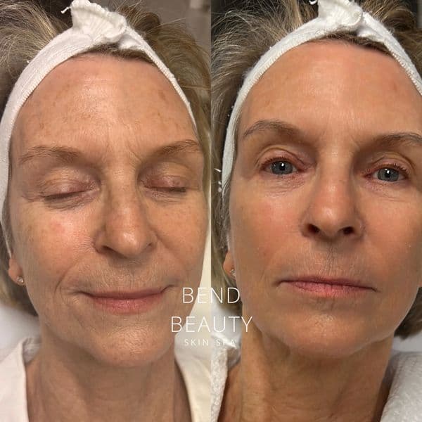 Client before-and-after comparison 2