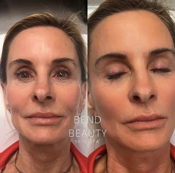 Client before-and-after comparison 3